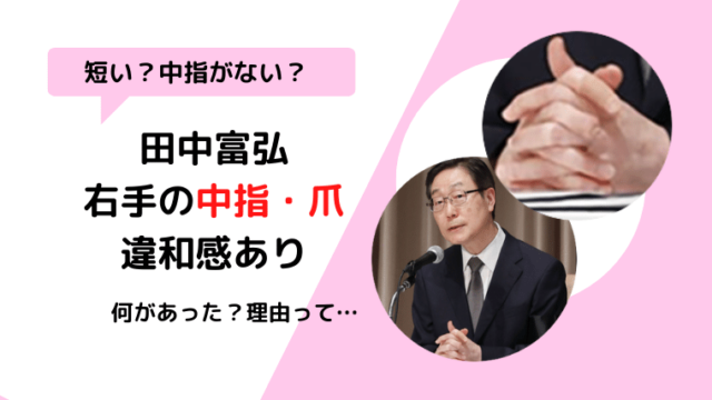 【画像】田中富弘の右手中指がない短い？爪が変な理由は何？